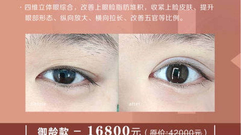 家用美容仪，揭秘适合哪些年龄段人群