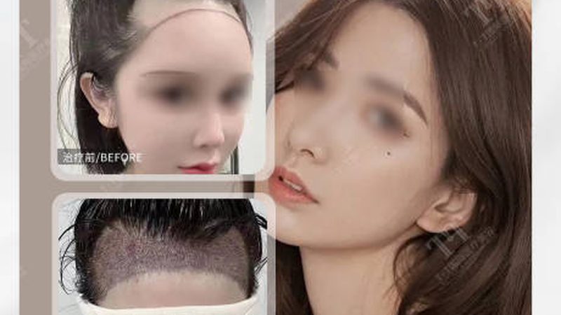 小型皮肤管理仪器：揭秘价格背后的秘密**