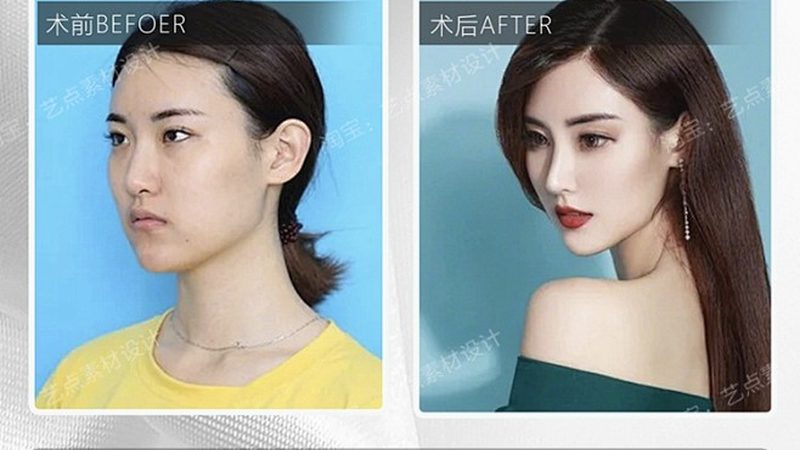 小标题：家用光子嫩肤仪的美白原理