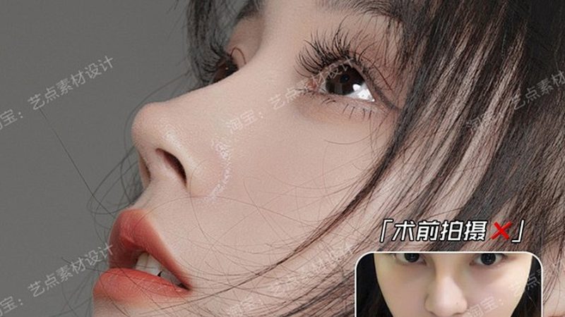 埋线提升，线材选择背后的科学考量
