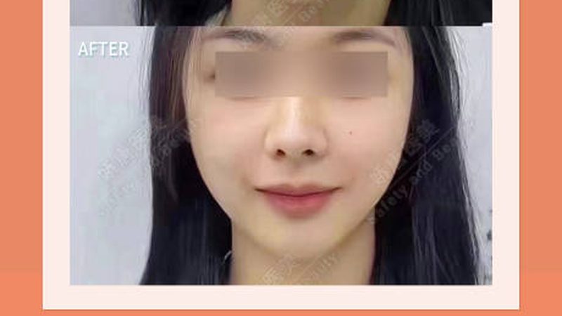 郑州注射美容医院对比分析