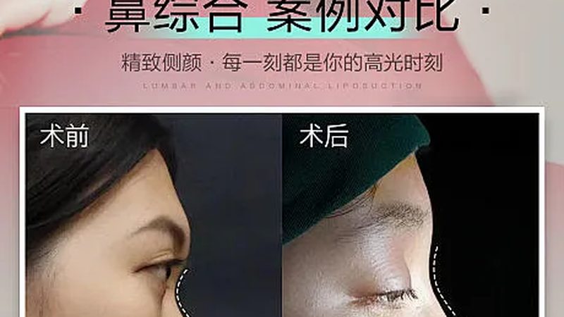 医美整形价格表对比