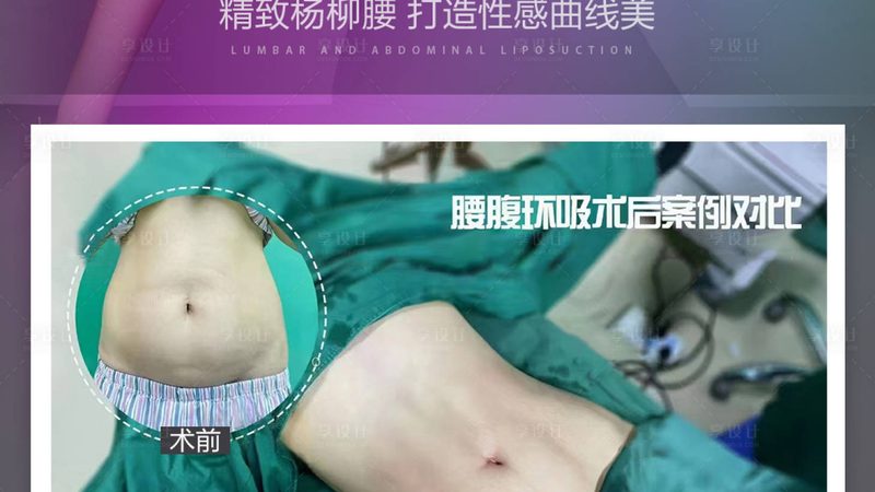 小标题：激光祛斑的原理