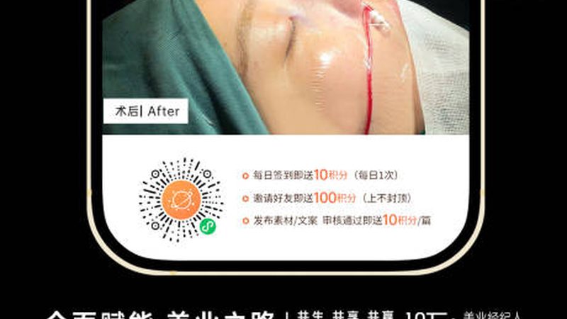 激光脱毛注意事项及术后护理