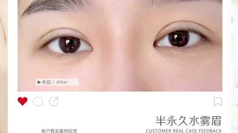 上海光子嫩肤仪器批发市场