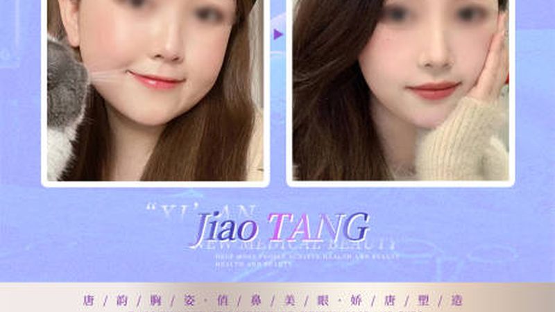 埋线提升与热玛吉：30岁女性的抗衰之选