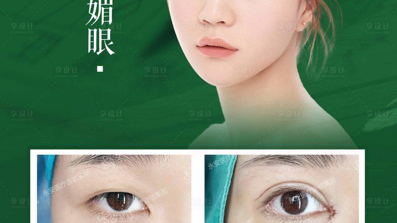 成都超声炮医院面诊，这些步骤你不可不知